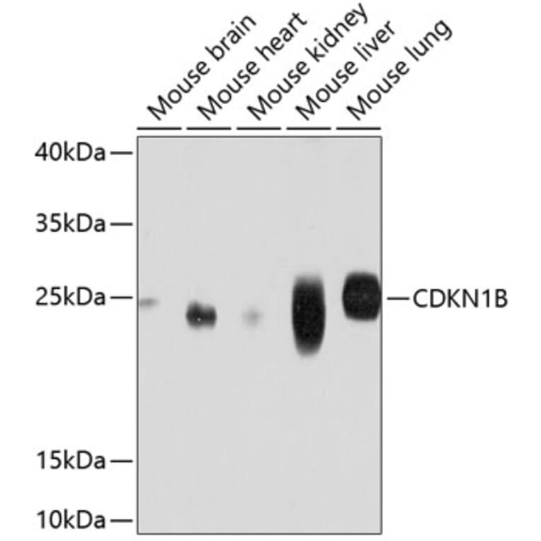 Western Blot - Anti-CDKN1B Antibody (A11800) - Antibodies.com