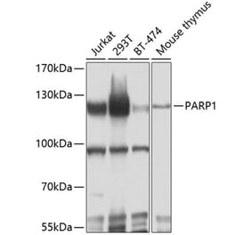 Western Blot - Anti-PARP1 Antibody (A80773) - Antibodies.com
