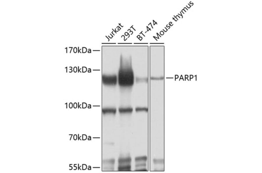Western Blot - Anti-PARP1 Antibody (A80773) - Antibodies.com