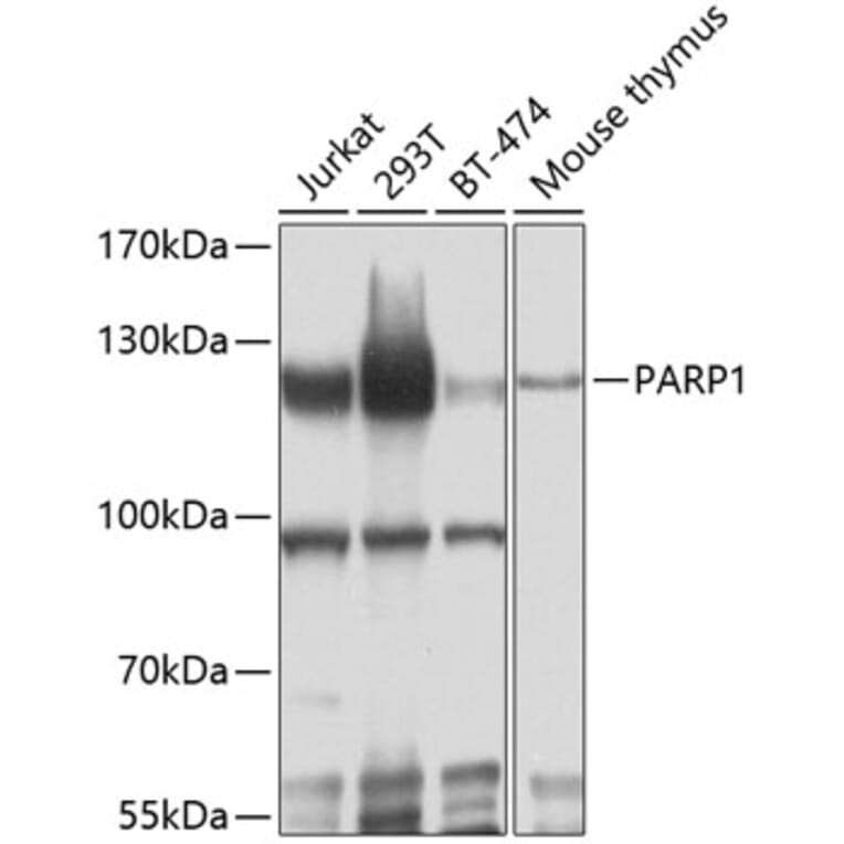 Western Blot - Anti-PARP1 Antibody (A80773) - Antibodies.com
