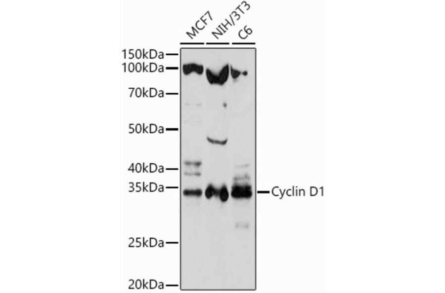 Western Blot - Anti-Cyclin D1 Antibody (A80774) - Antibodies.com