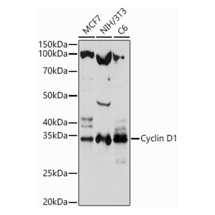 Western Blot - Anti-Cyclin D1 Antibody (A80774) - Antibodies.com