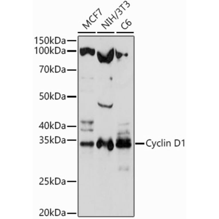 Western Blot - Anti-Cyclin D1 Antibody (A80774) - Antibodies.com