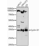 Western Blot - Anti-Cyclin D1 Antibody (A80774) - Antibodies.com