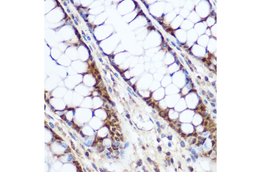 Immunohistochemistry - Anti-Cyclin D1 Antibody (A80774) - Antibodies.com