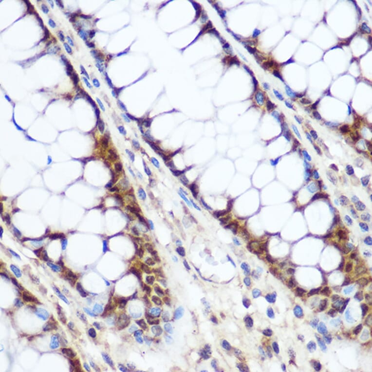 Immunohistochemistry - Anti-Cyclin D1 Antibody (A80774) - Antibodies.com