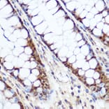 Immunohistochemistry - Anti-Cyclin D1 Antibody (A80774) - Antibodies.com