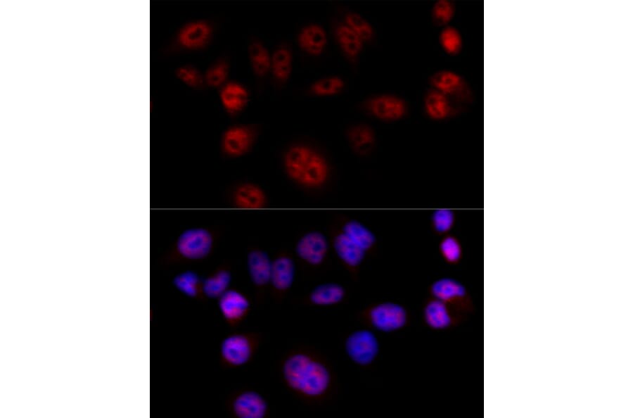 Immunofluorescence - Anti-Cyclin D1 Antibody (A80774) - Antibodies.com