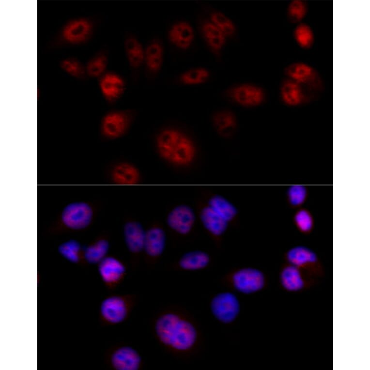 Immunofluorescence - Anti-Cyclin D1 Antibody (A80774) - Antibodies.com