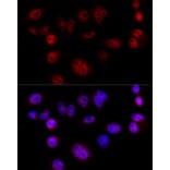 Immunofluorescence - Anti-Cyclin D1 Antibody (A80774) - Antibodies.com
