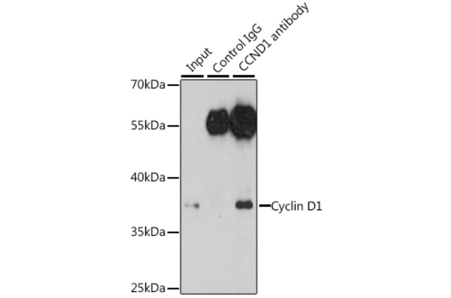 Western Blot - Anti-Cyclin D1 Antibody (A80774) - Antibodies.com