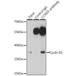 Western Blot - Anti-Cyclin D1 Antibody (A80774) - Antibodies.com
