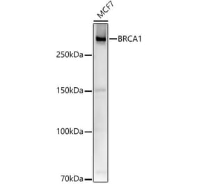 Western Blot - Anti-BRCA1 Antibody (A80775) - Antibodies.com