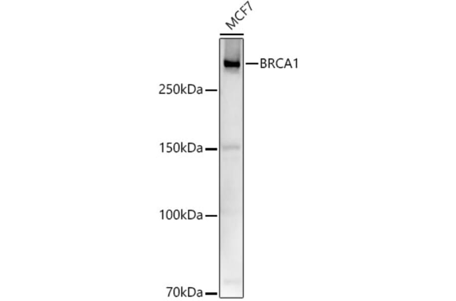 Western Blot - Anti-BRCA1 Antibody (A80775) - Antibodies.com