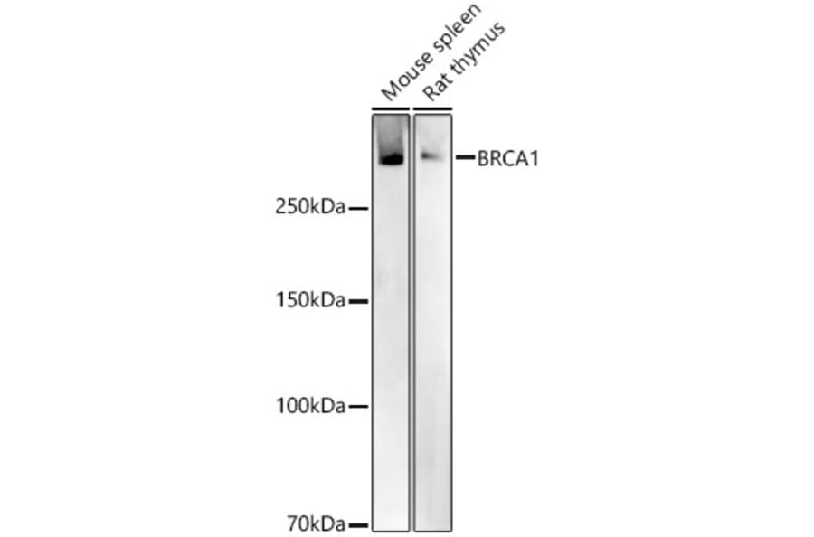 Western Blot - Anti-BRCA1 Antibody (A80775) - Antibodies.com