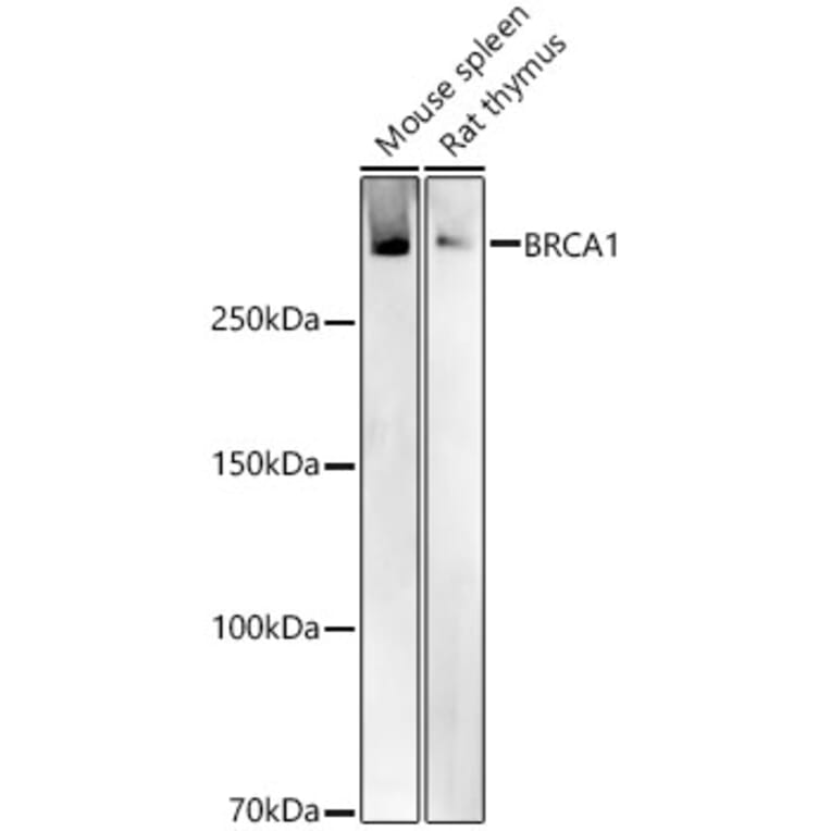 Western Blot - Anti-BRCA1 Antibody (A80775) - Antibodies.com