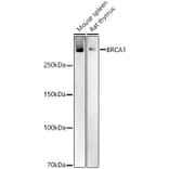 Western Blot - Anti-BRCA1 Antibody (A80775) - Antibodies.com