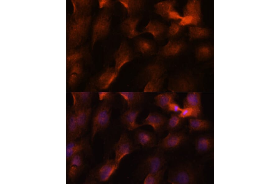 Immunofluorescence - Anti-BRCA1 Antibody (A80775) - Antibodies.com