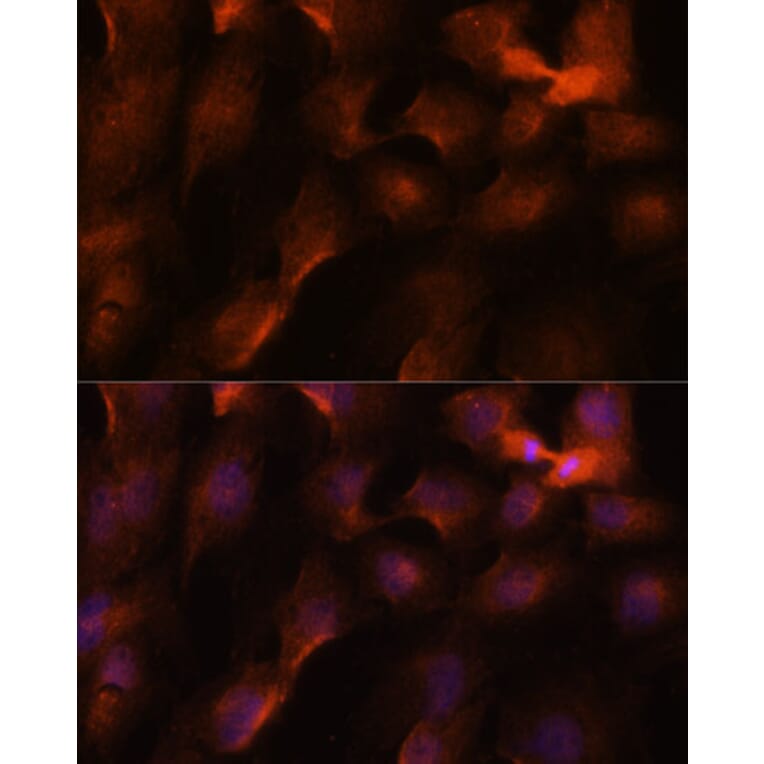 Immunofluorescence - Anti-BRCA1 Antibody (A80775) - Antibodies.com