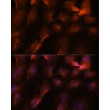 Immunofluorescence - Anti-BRCA1 Antibody (A80775) - Antibodies.com