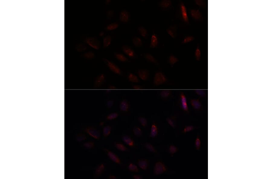 Immunofluorescence - Anti-BRCA1 Antibody (A80775) - Antibodies.com