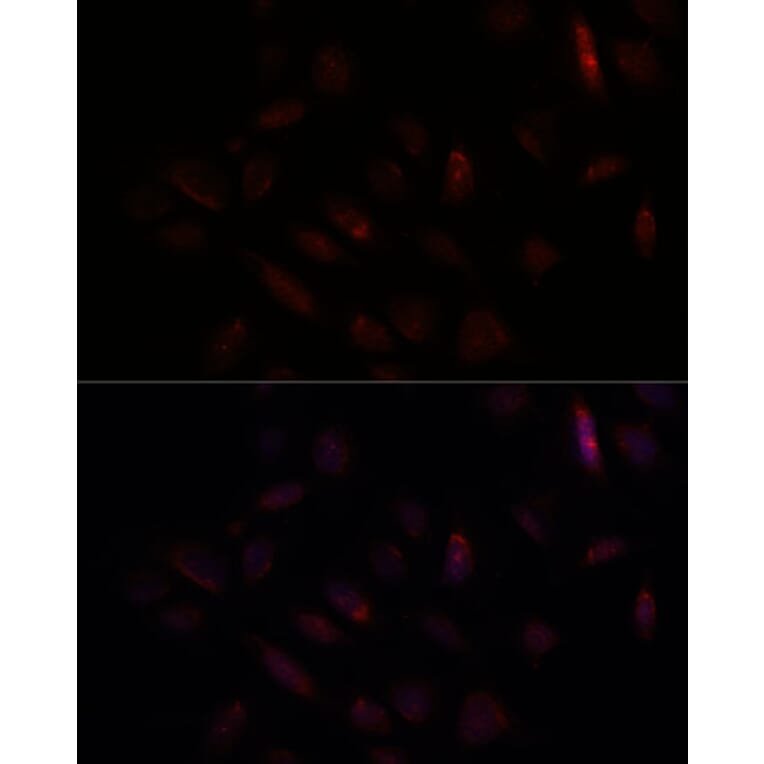 Immunofluorescence - Anti-BRCA1 Antibody (A80775) - Antibodies.com