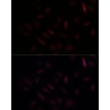 Immunofluorescence - Anti-BRCA1 Antibody (A80775) - Antibodies.com