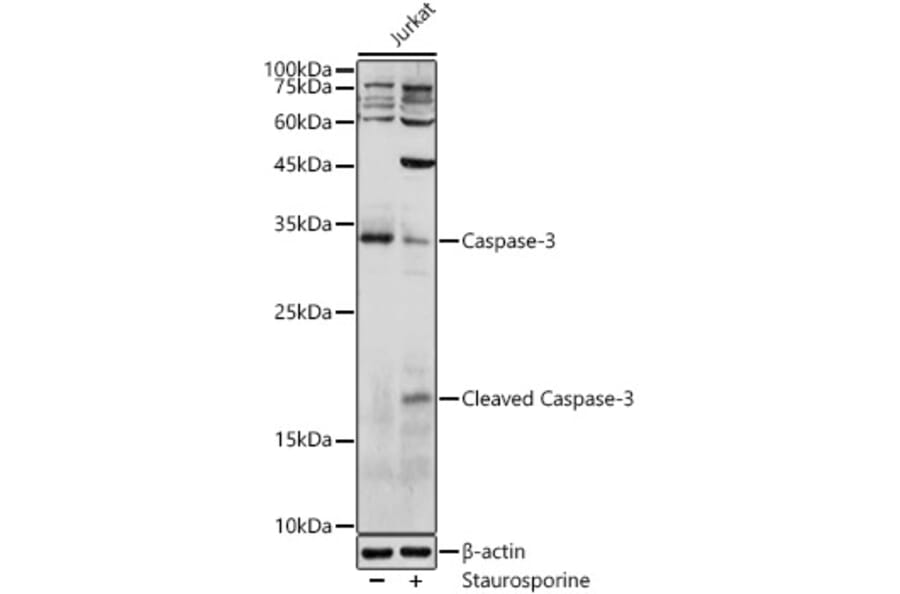 Western Blot - Anti-Caspase-3 Antibody (A80776) - Antibodies.com