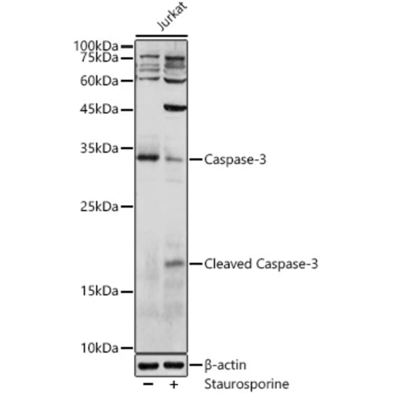 Western Blot - Anti-Caspase-3 Antibody (A80776) - Antibodies.com