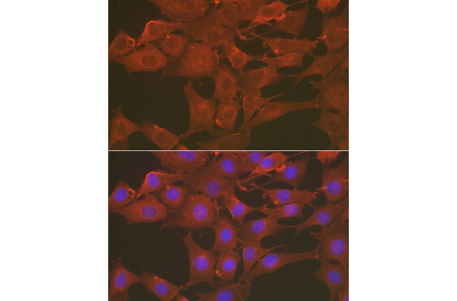 Immunofluorescence - Anti-Caspase-3 Antibody (A80776) - Antibodies.com