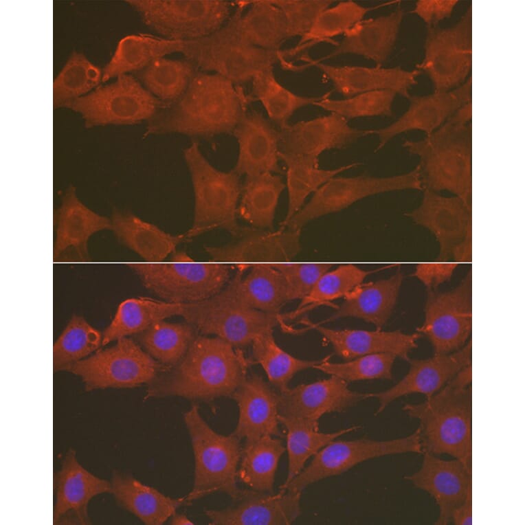 Immunofluorescence - Anti-Caspase-3 Antibody (A80776) - Antibodies.com