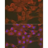 Immunofluorescence - Anti-Caspase-3 Antibody (A80776) - Antibodies.com