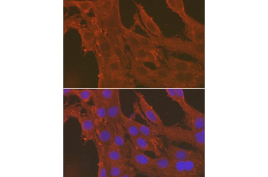 Immunofluorescence - Anti-Caspase-3 Antibody (A80776) - Antibodies.com