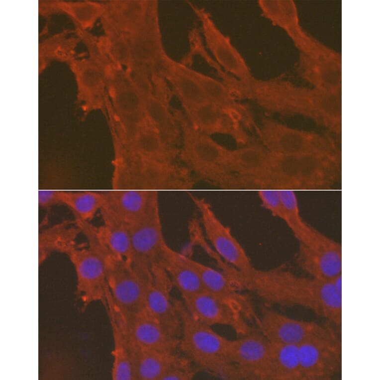 Immunofluorescence - Anti-Caspase-3 Antibody (A80776) - Antibodies.com