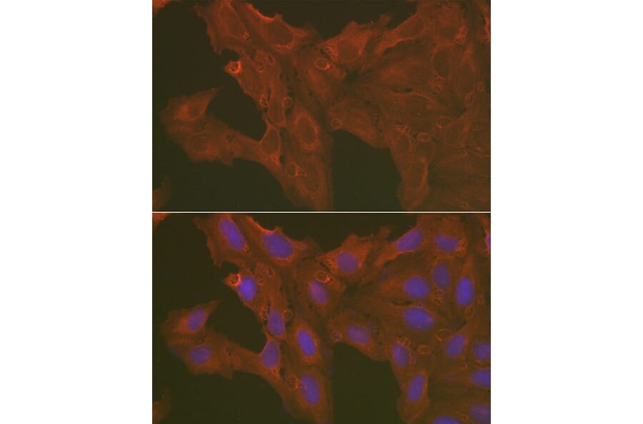 Immunofluorescence - Anti-Caspase-3 Antibody (A80776) - Antibodies.com