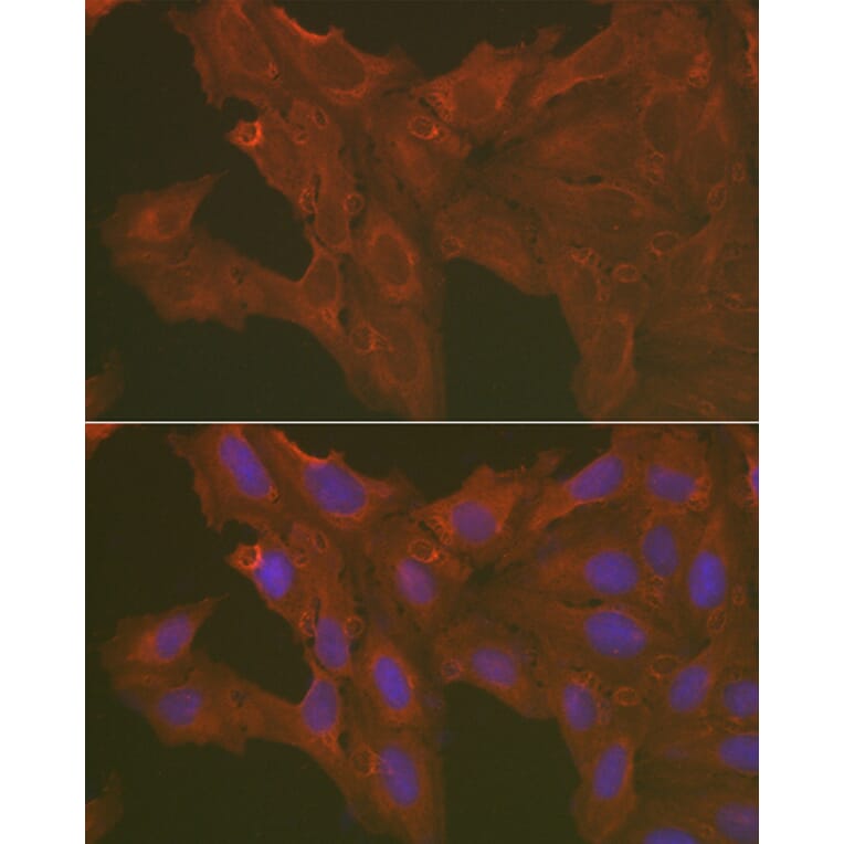 Immunofluorescence - Anti-Caspase-3 Antibody (A80776) - Antibodies.com