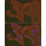 Immunofluorescence - Anti-Caspase-3 Antibody (A80776) - Antibodies.com
