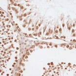 Immunohistochemistry - Anti-Histone H2A.X Antibody (A80779) - Antibodies.com