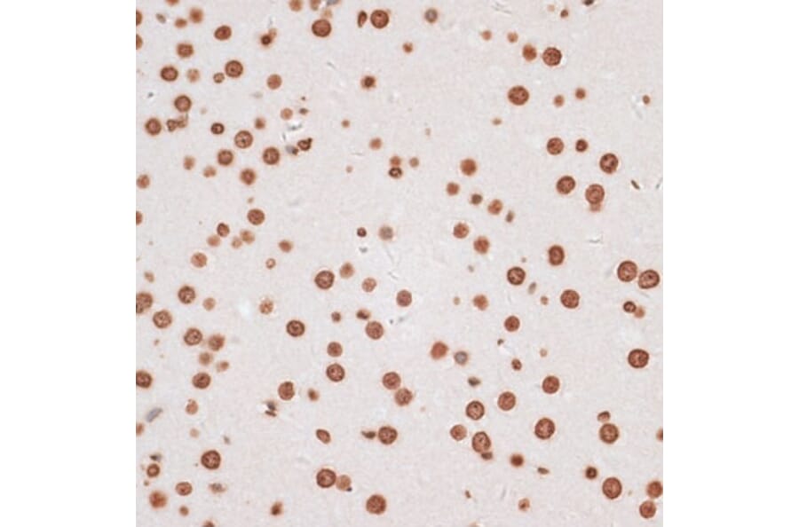 Immunohistochemistry - Anti-Histone H2A.X Antibody (A80779) - Antibodies.com