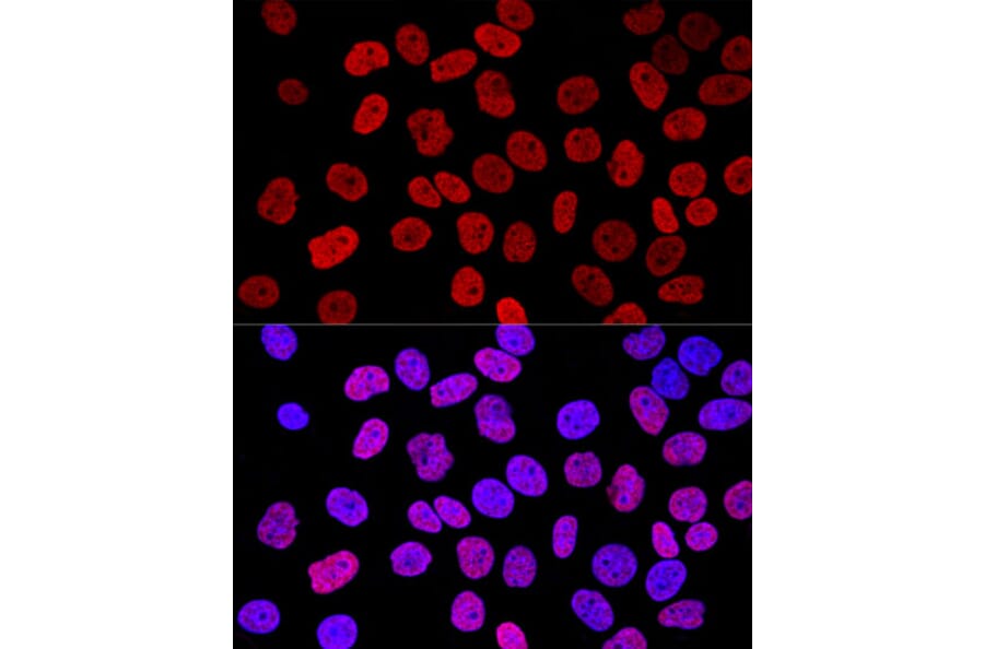 Immunofluorescence - Anti-Histone H2A.X Antibody (A80779) - Antibodies.com