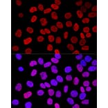 Immunofluorescence - Anti-Histone H2A.X Antibody (A80779) - Antibodies.com