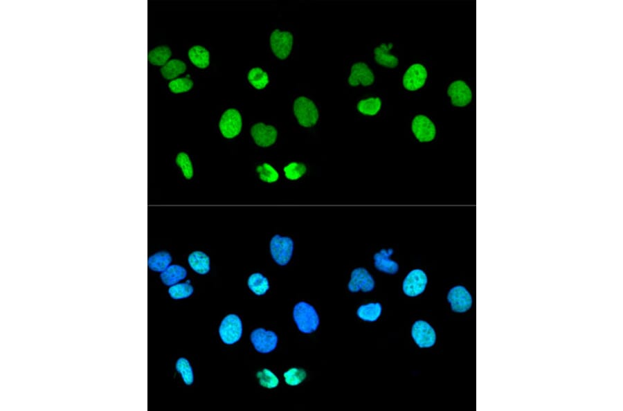Immunofluorescence - Anti-Histone H2A.X Antibody (A80779) - Antibodies.com