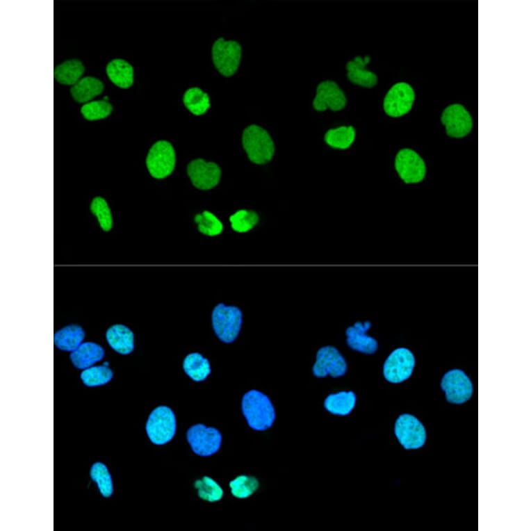 Immunofluorescence - Anti-Histone H2A.X Antibody (A80779) - Antibodies.com