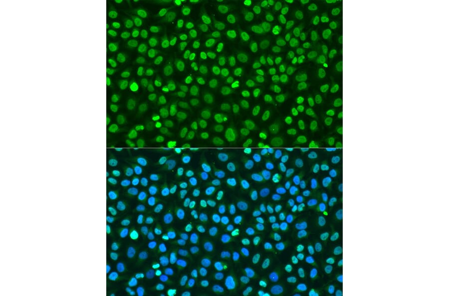 Immunofluorescence - Anti-Histone H2A.X Antibody (A80779) - Antibodies.com