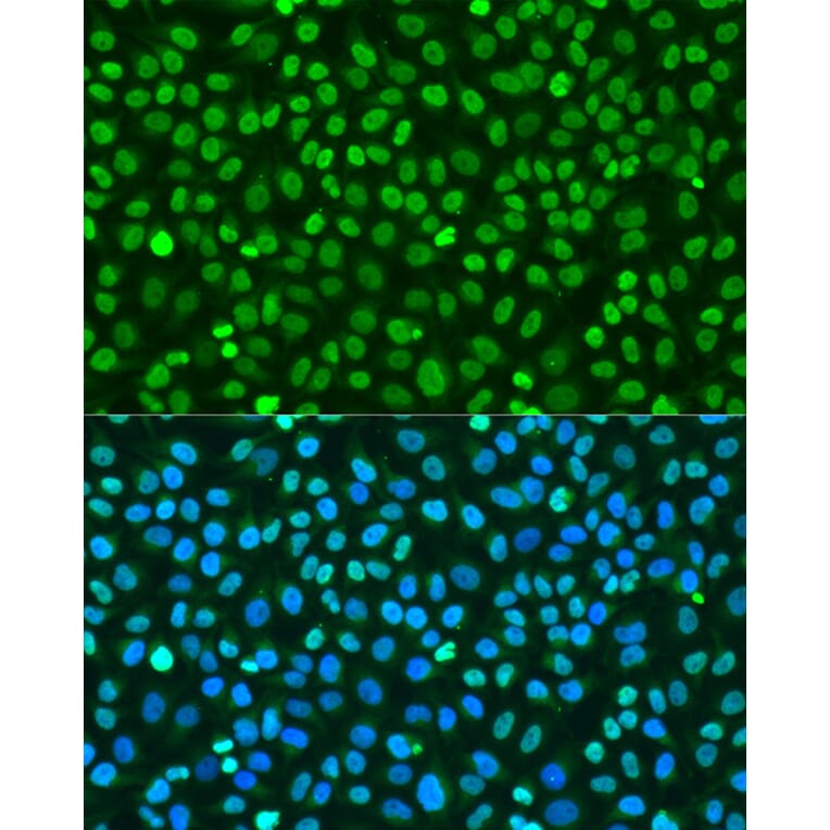 Immunofluorescence - Anti-Histone H2A.X Antibody (A80779) - Antibodies.com