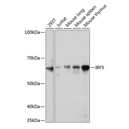 Western Blot - Anti-IRF5 Antibody [ARC0525] (A80782) - Antibodies.com