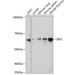 Western Blot - Anti-IRF5 Antibody [ARC0525] (A80782) - Antibodies.com