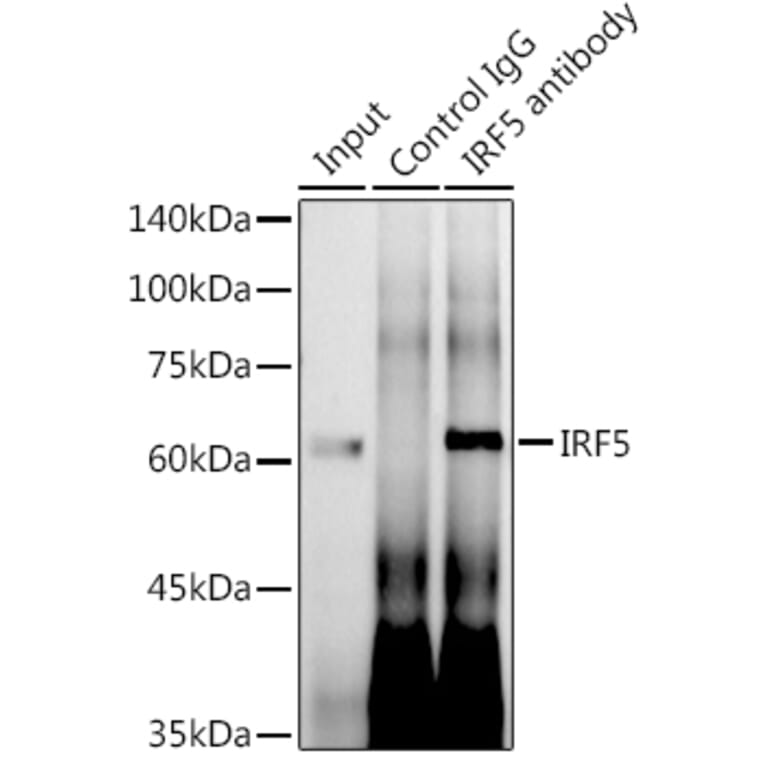 Western Blot - Anti-IRF5 Antibody [ARC0525] (A80782) - Antibodies.com