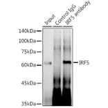 Western Blot - Anti-IRF5 Antibody [ARC0525] (A80782) - Antibodies.com