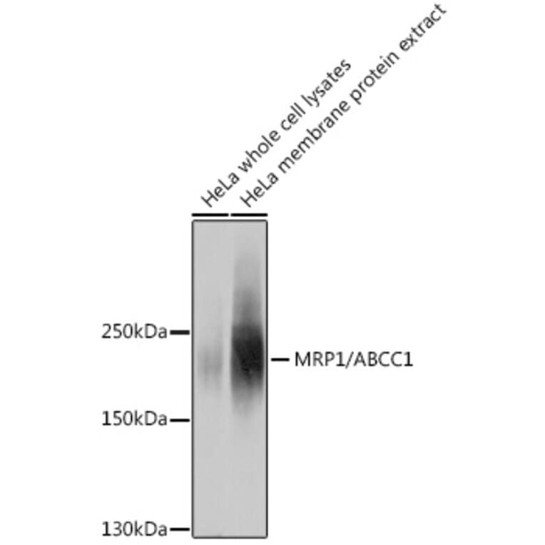 Western Blot - Anti-MRP1 Antibody (A80784) - Antibodies.com